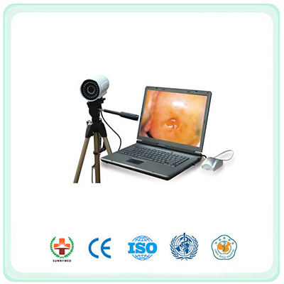 SY9800 Portable Digital Electronic Colposcope